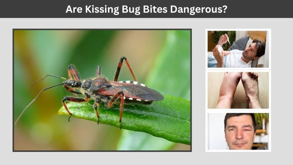 Are Kissing Bug Bites Dangerous?