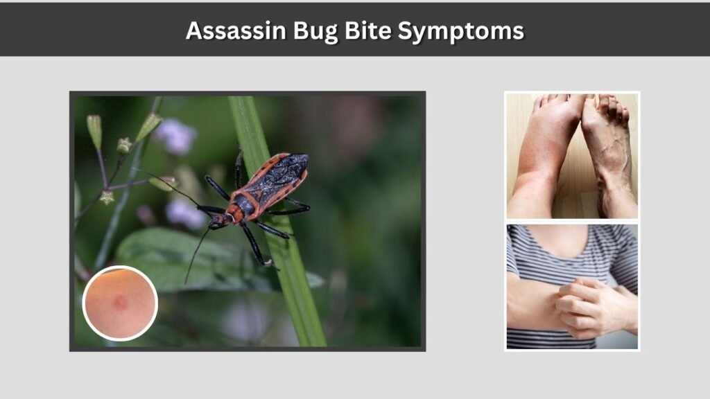 Assassin Bug Bite Symptoms