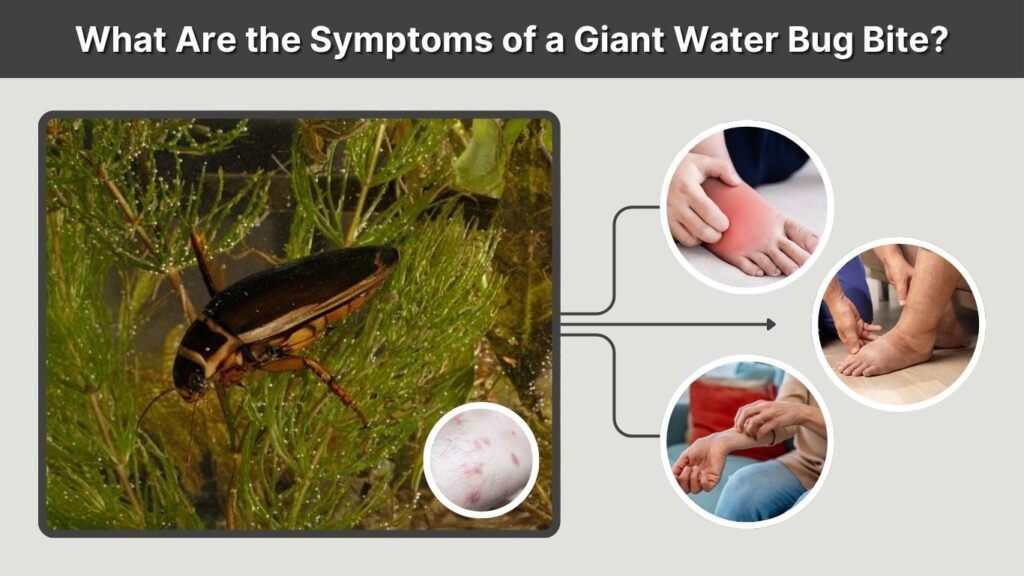 What Are the Symptoms of a Giant Water Bug Bite?