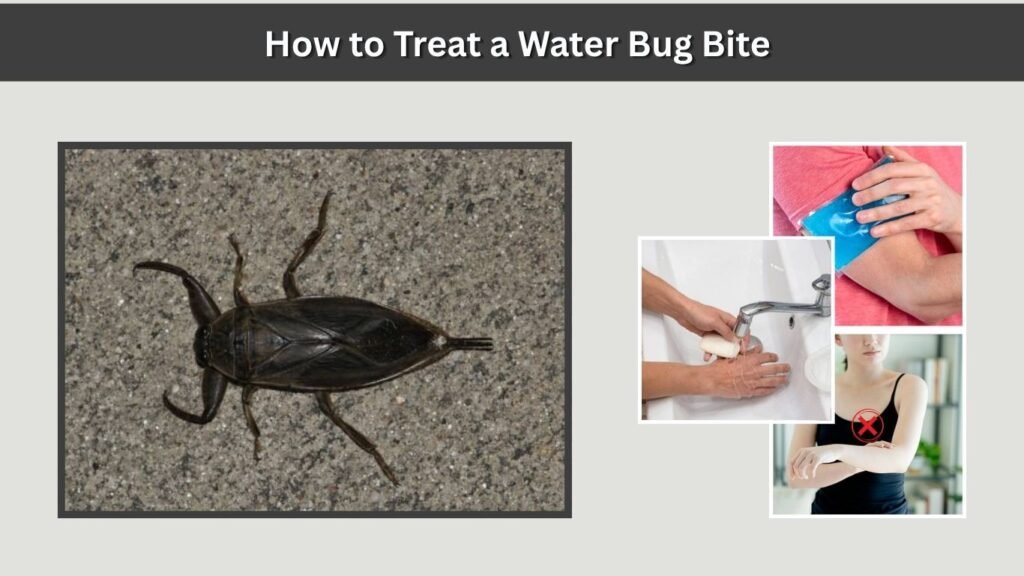 How to Treat a Water Bug Bite