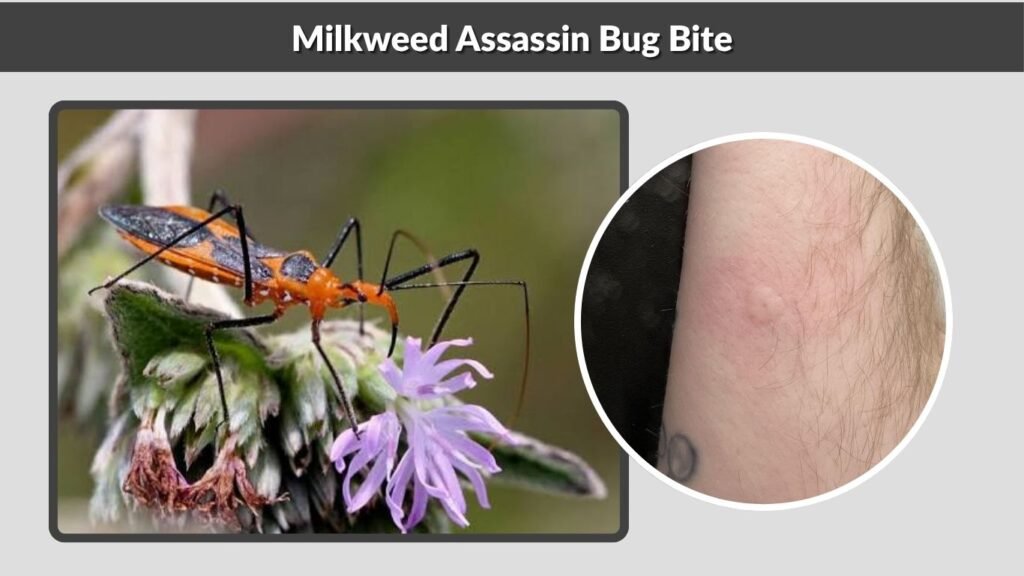 Milkweed Assassin Bug Bite
