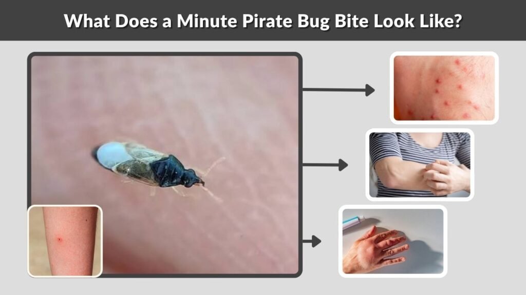 What Does a Minute Pirate Bug Bite Look Like?