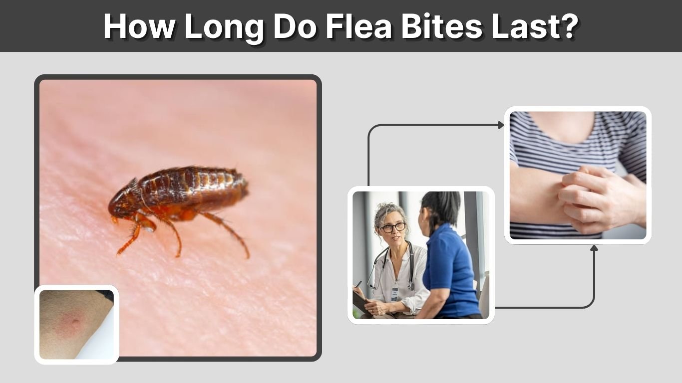How Long Do Flea Bites Last? Healing Time and Treatment