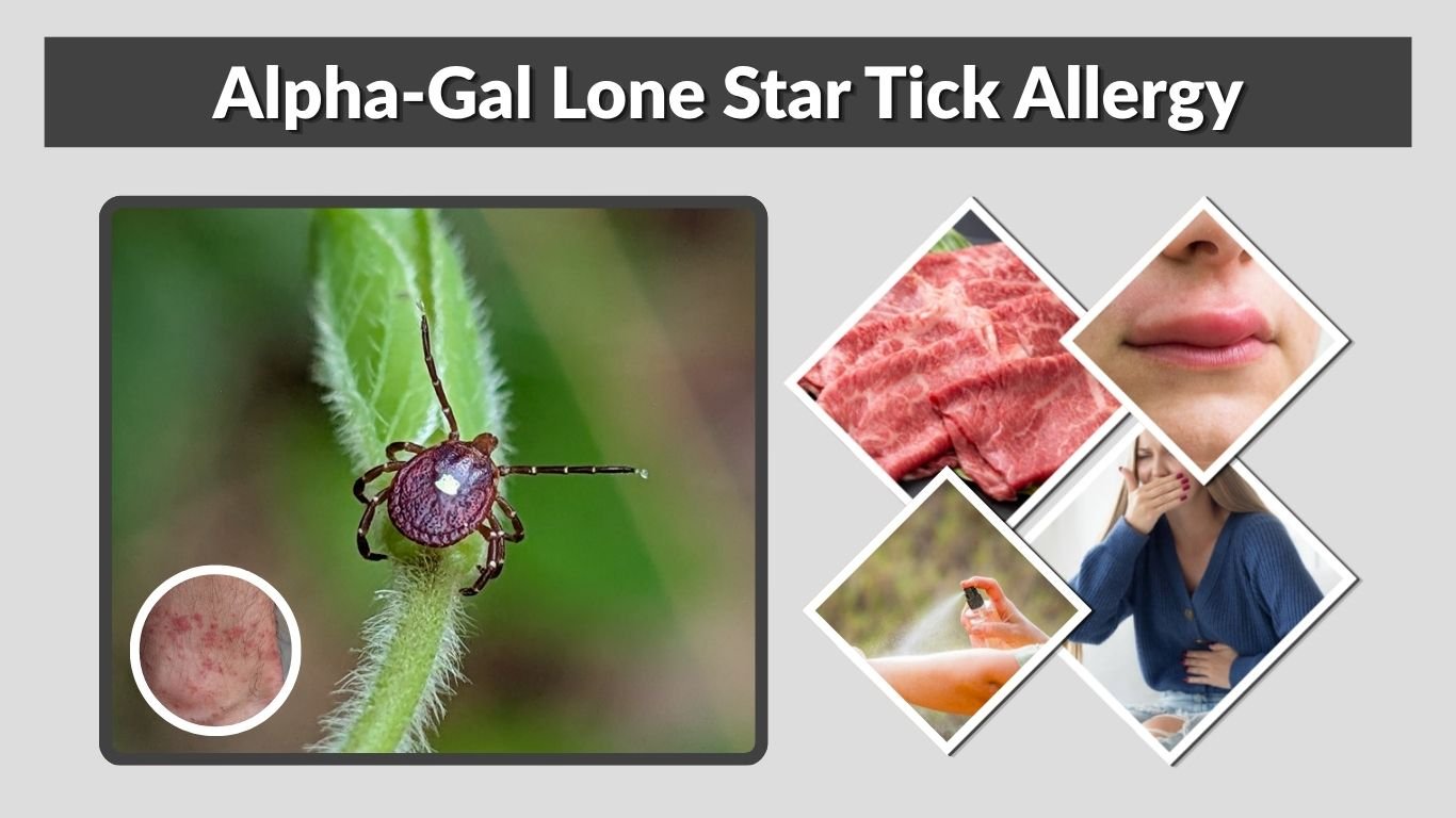Alpha-Gal Lone Star Tick Allergy: Symptoms, Risks & Care