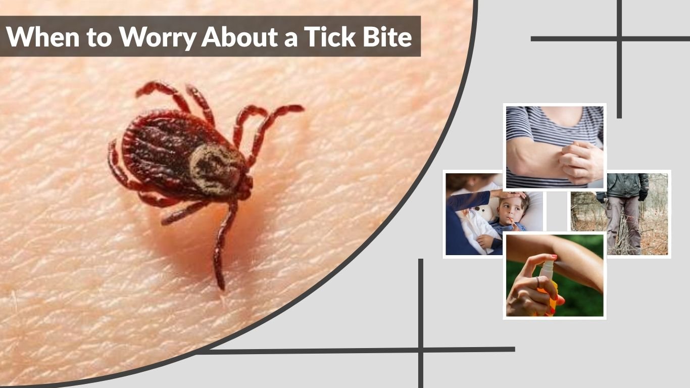 When to Worry About a Tick Bite: Signs You Shouldn’t Ignore