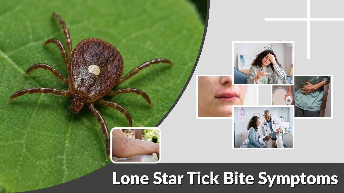 Lone Star Tick Bite Symptoms: Timeline, Rash & Allergy