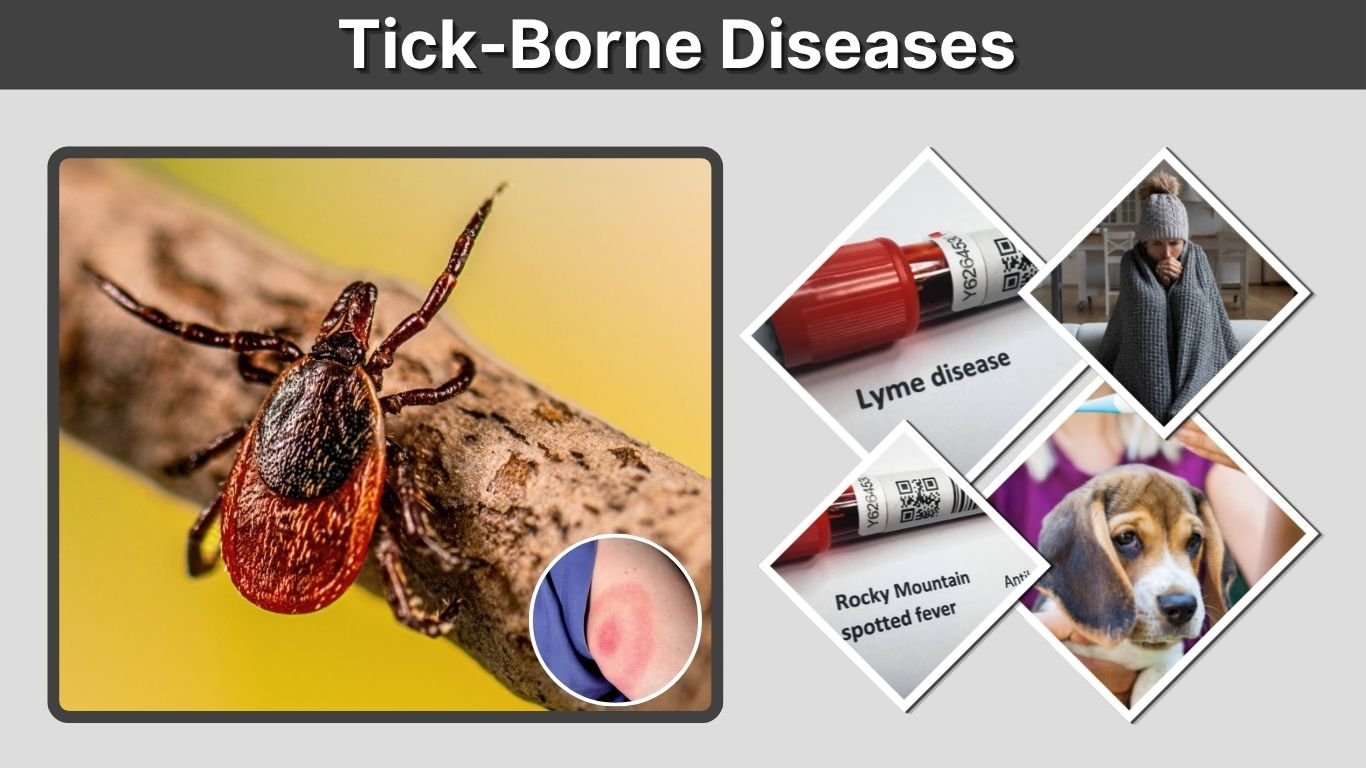 Tick-Borne Diseases: Types, Symptoms, Treatment and Prevention