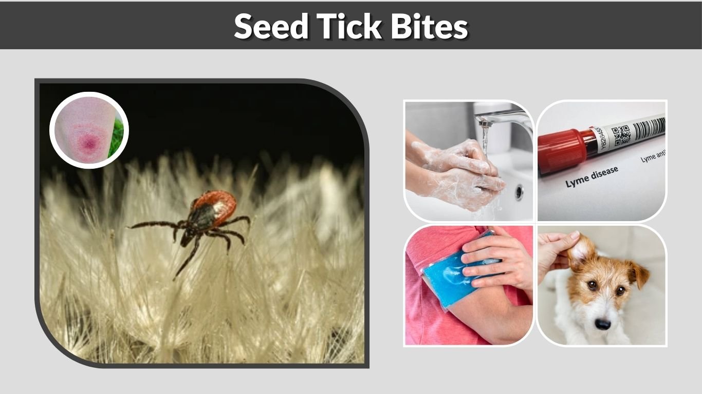 Seed Tick Bites: Symptoms, Treatment, and Itch Relief