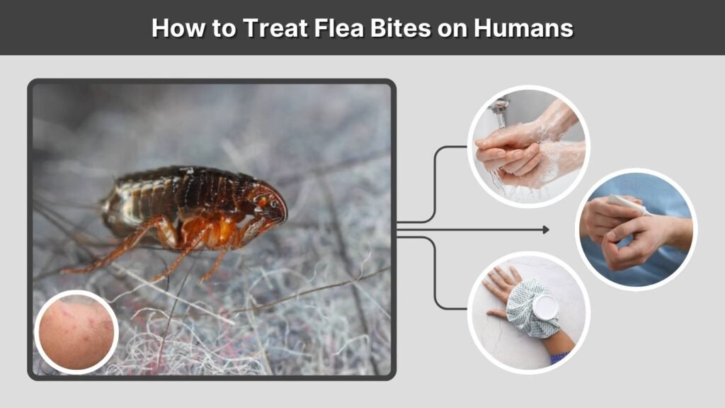 How to Treat Flea Bites on Humans