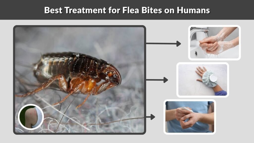 Best Treatment for Flea Bites on Humans