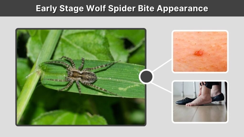 Early Stage Wolf Spider Bite Appearance