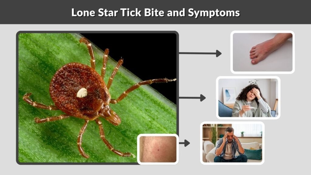 Lone Star Tick Bite and Symptoms
