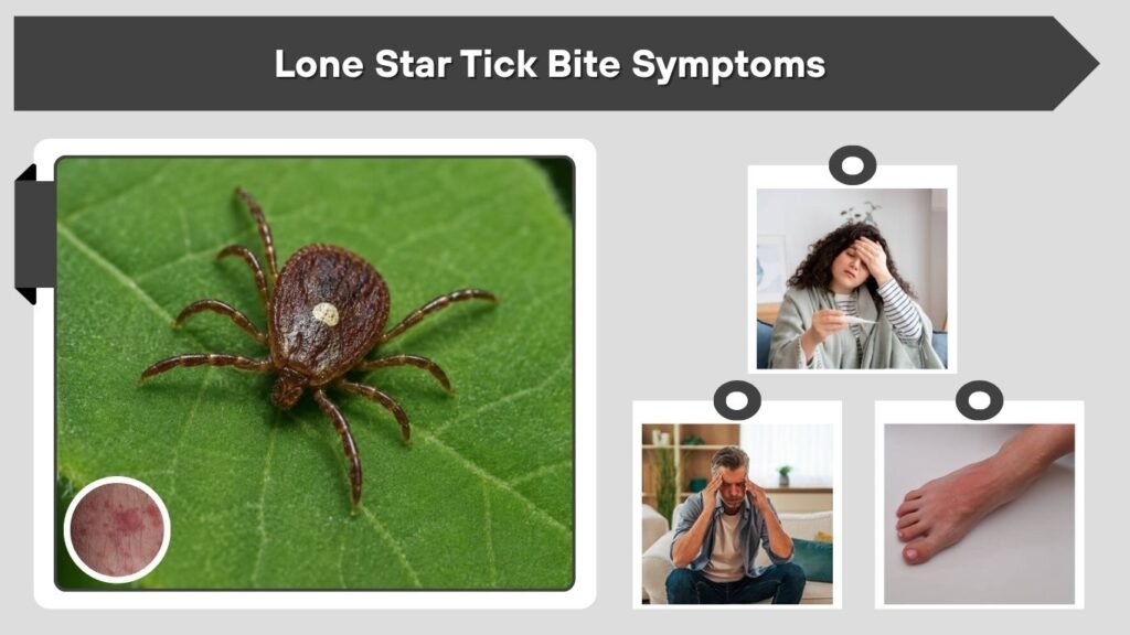 Lone Star Tick Bite Symptoms