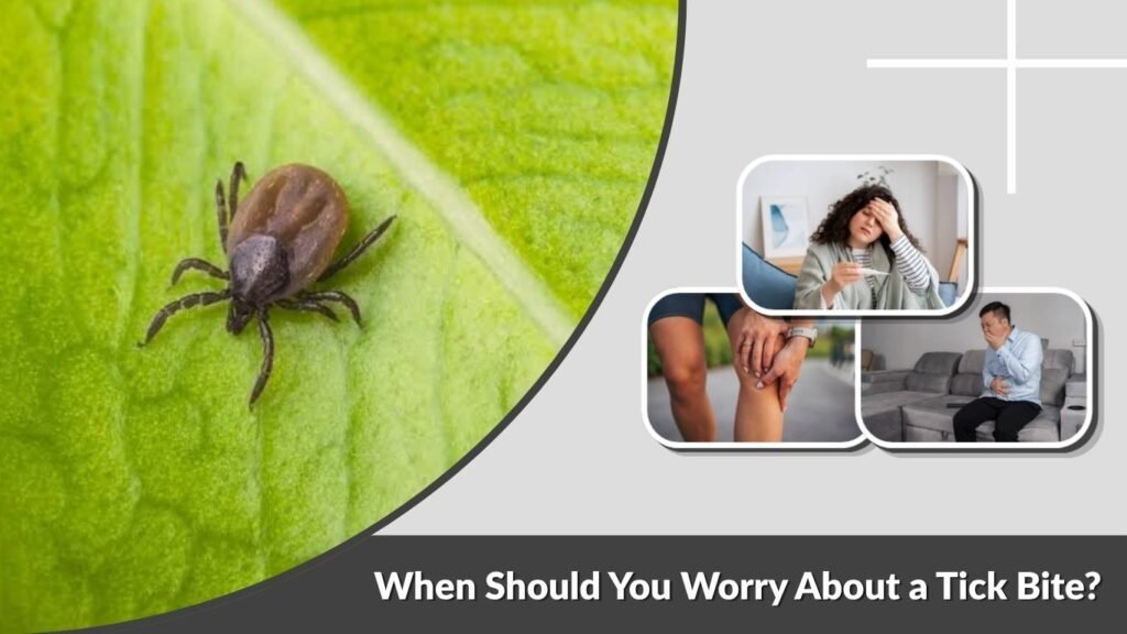 When Should You Worry About a Tick Bite?