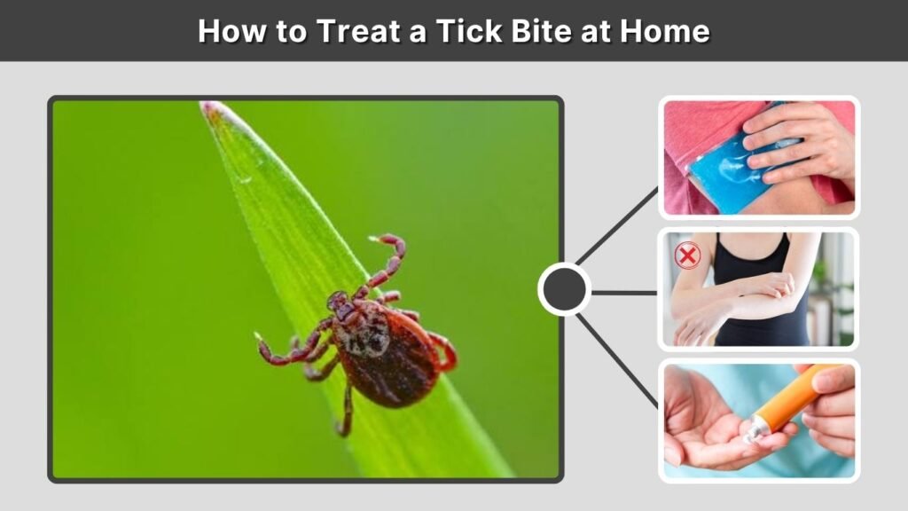 How to Treat a Tick Bite at Home