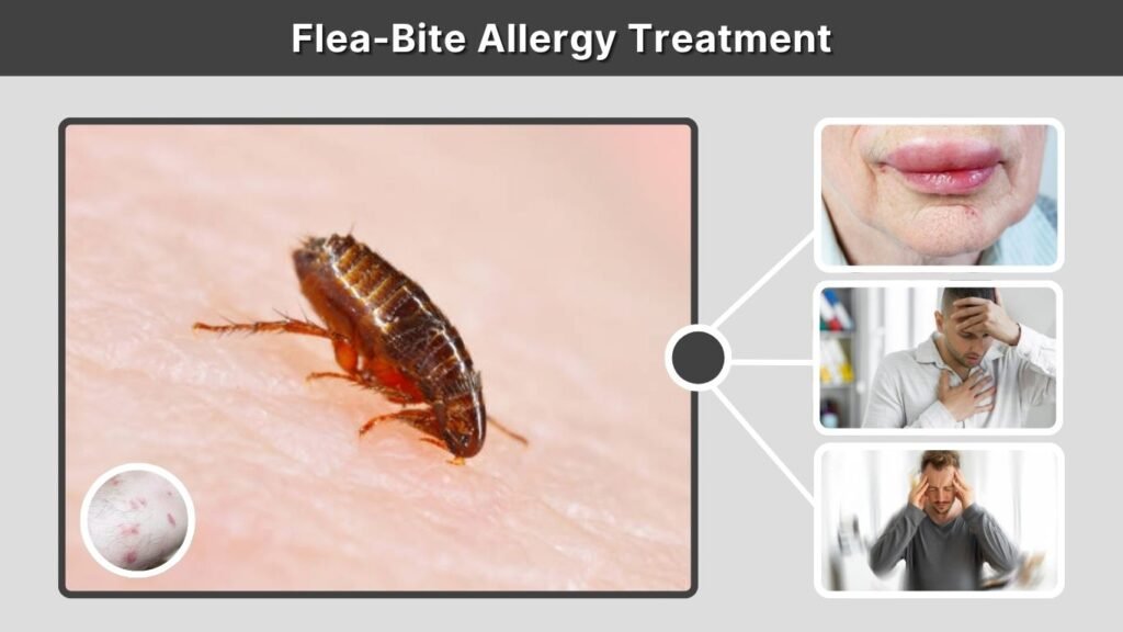 Flea-Bite Allergy Treatment