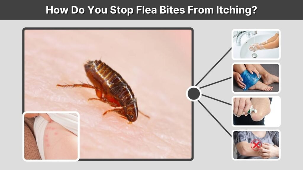 How Do You Stop Flea Bites From Itching?