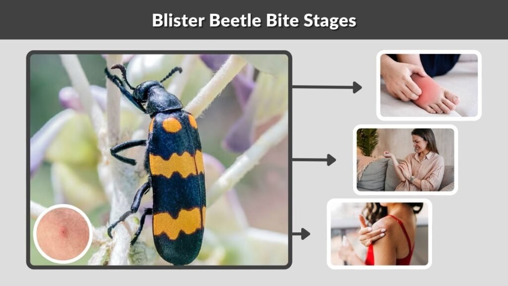 Blister Beetle Bite Stages