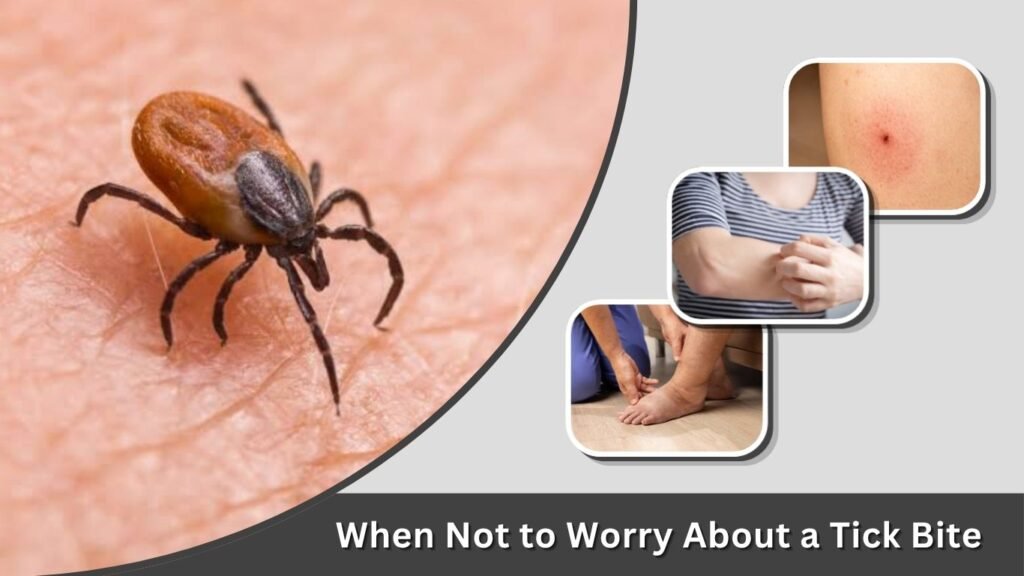 When Not to Worry About a Tick Bite