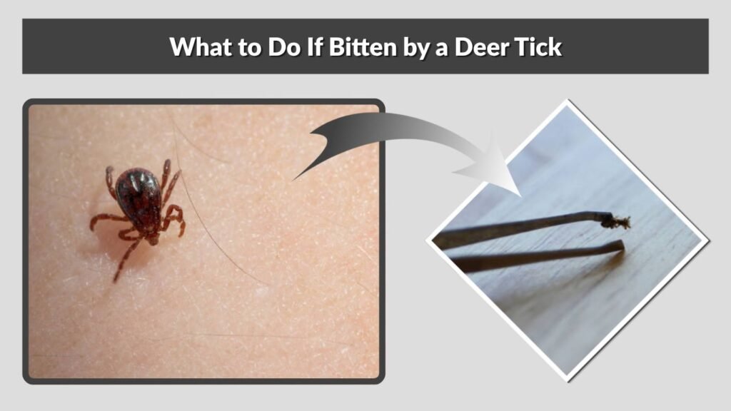 What to Do If Bitten by a Deer Tick
