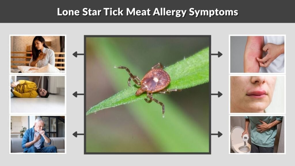 Lone Star Tick Meat Allergy Symptoms