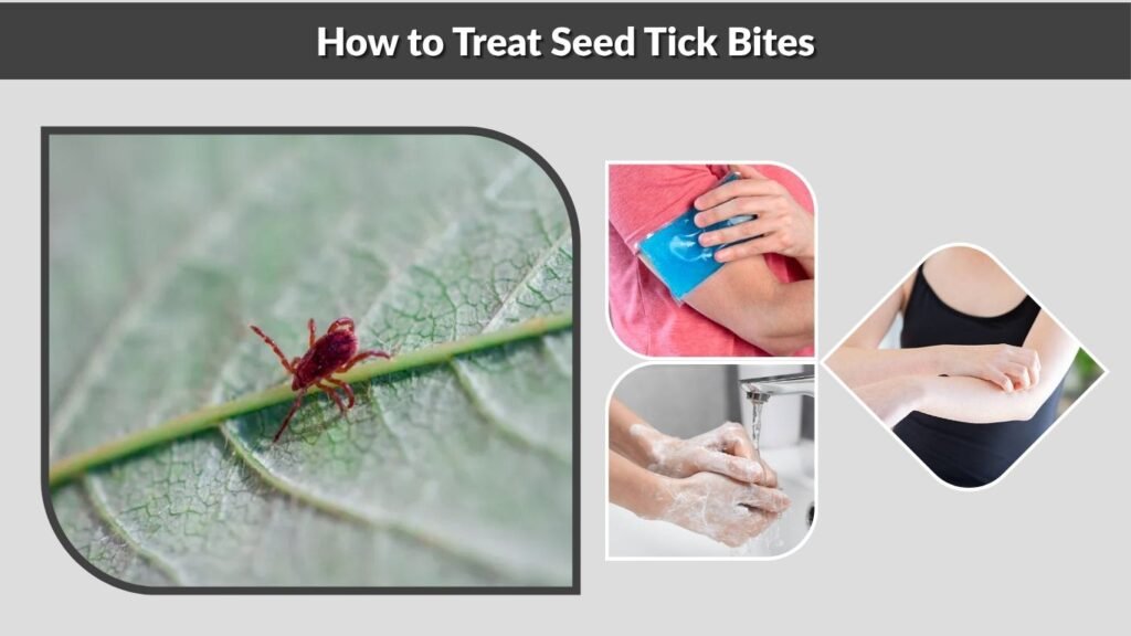 How to Treat Seed Tick Bites