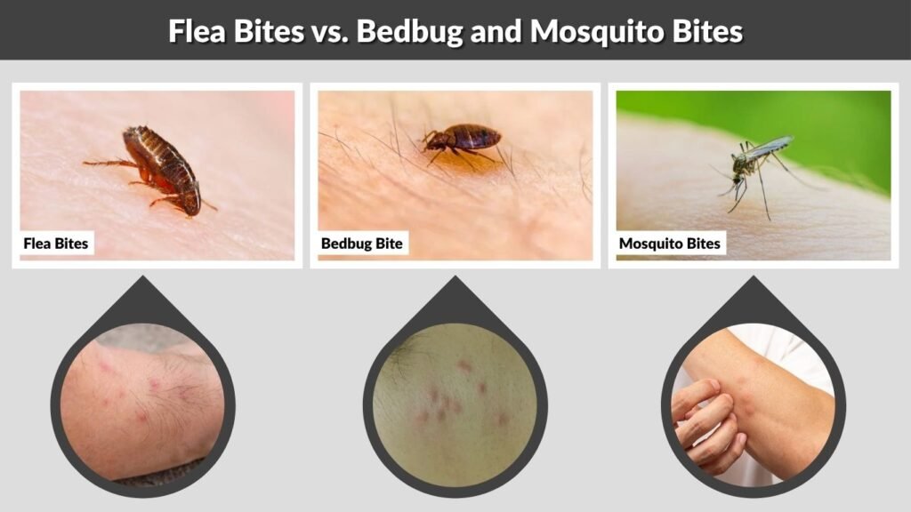 Flea Bites vs. Bedbug and Mosquito Bites