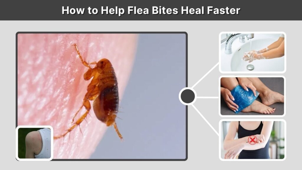 How to Help Flea Bites Heal Faster