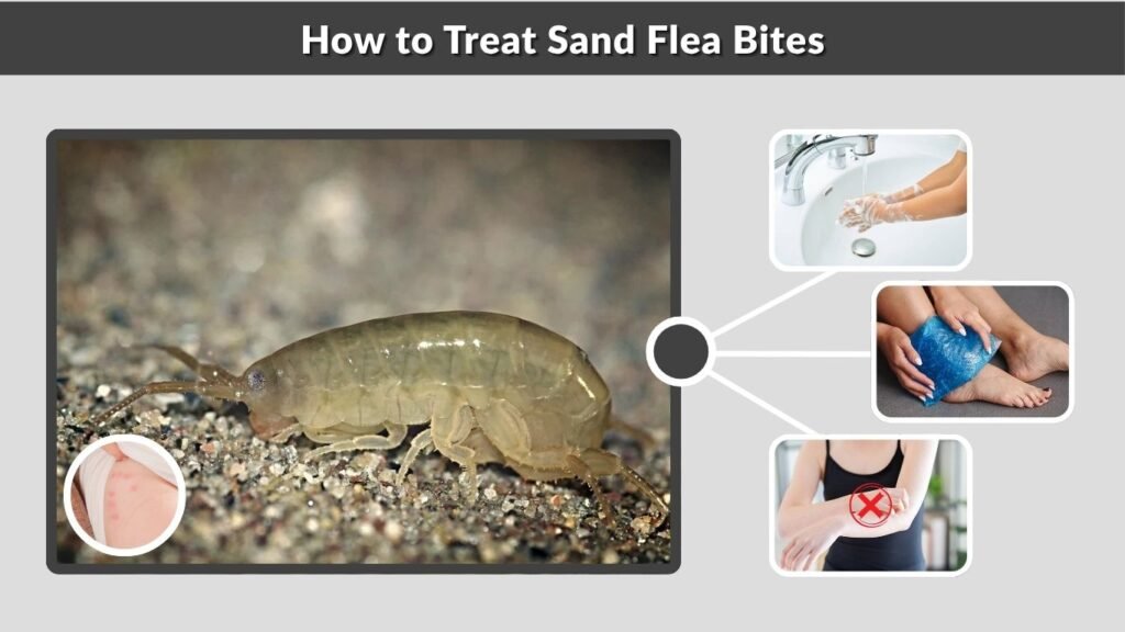 How to Treat Sand Flea Bites