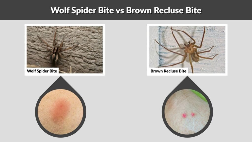 Wolf Spider Bite vs Brown Recluse Bite