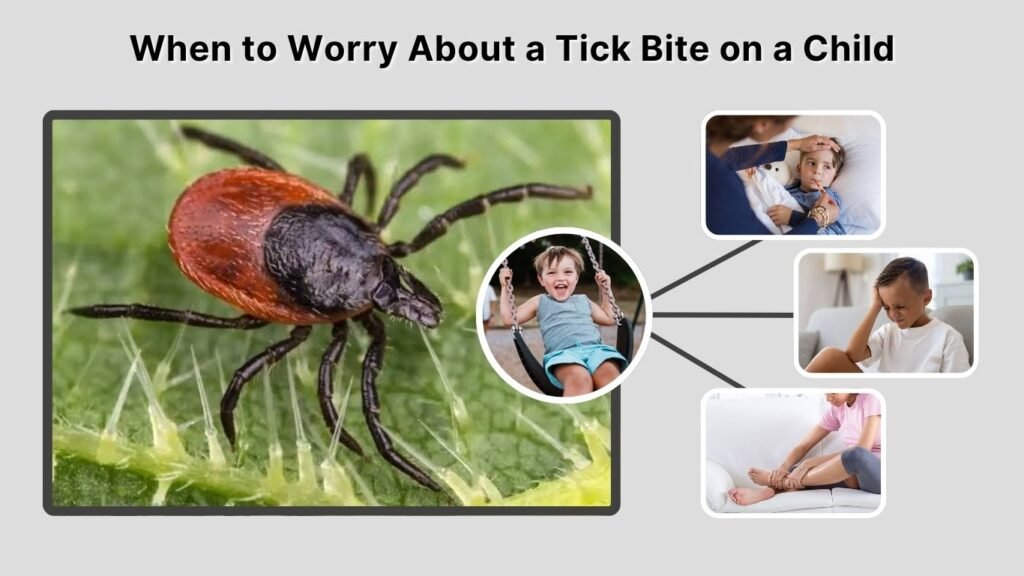When to Worry About a Tick Bite on a Child