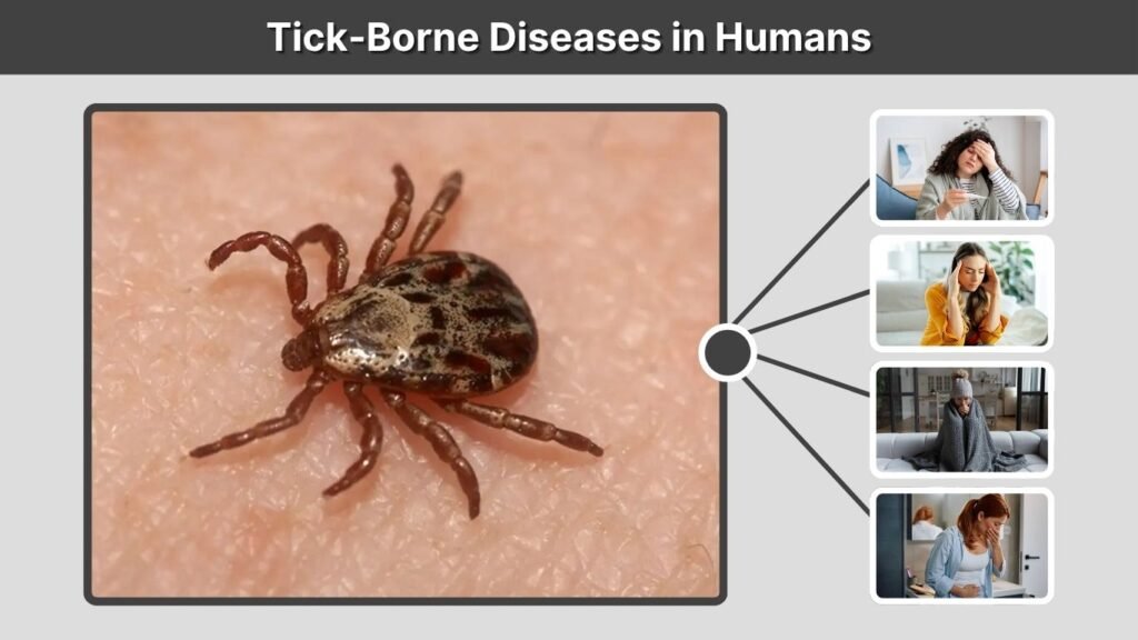 Tick-Borne Diseases in Humans