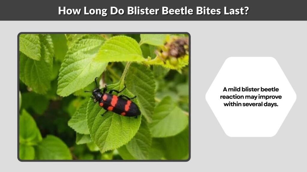 How Long Do Blister Beetle Bites Last?