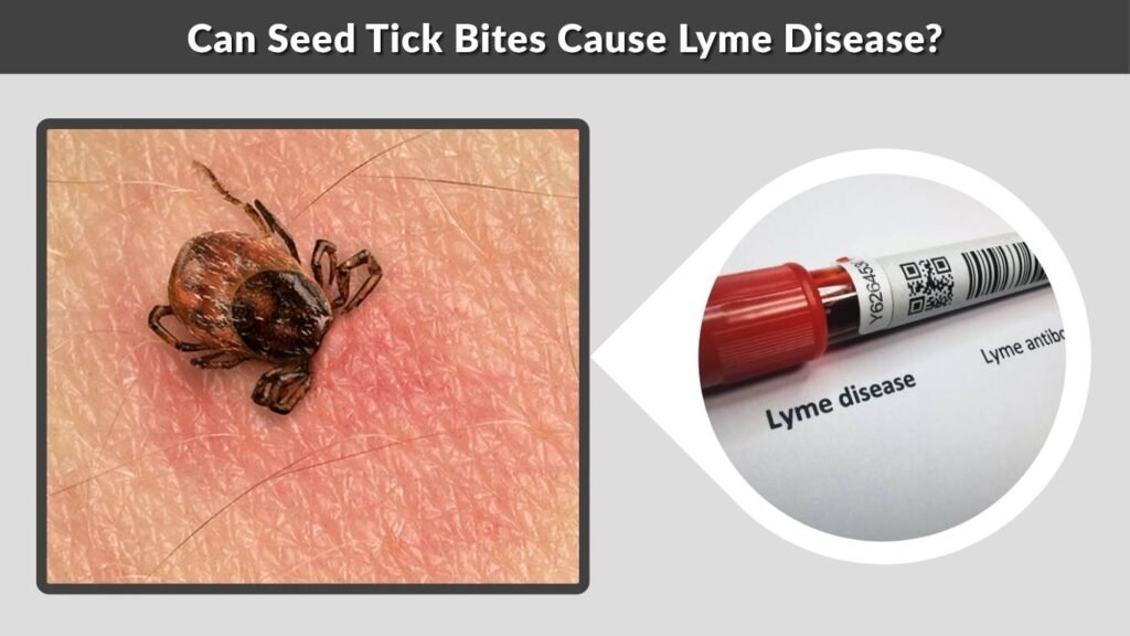 Can Seed Tick Bites Cause Lyme Disease?