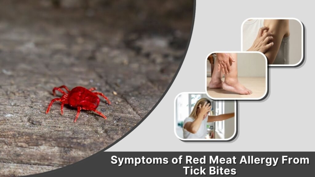 Symptoms of Red Meat Allergy From Tick Bites