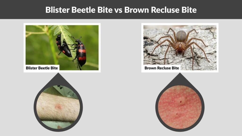 Blister Beetle Bite vs Brown Recluse Bite