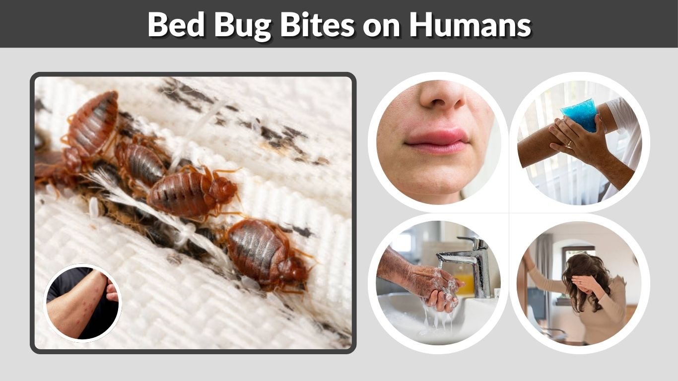 Bed Bug Bites on Humans: Signs, Pictures & Treatment