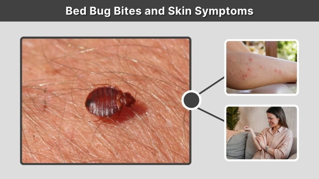 Bed Bug Bites and Skin Symptoms