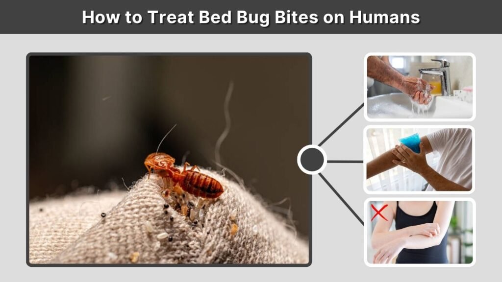 How to Treat Bed Bug Bites on Humans