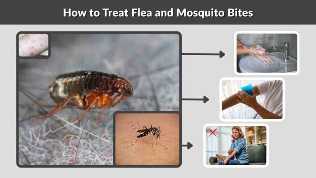 How to Treat Flea and Mosquito Bites