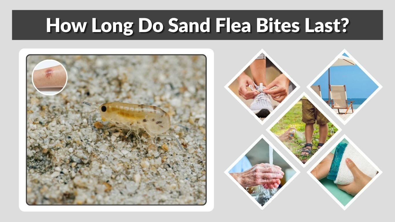 How Long Do Sand Flea Bites Last? Healing & Relief