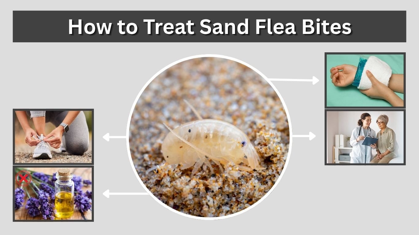 How to Treat Sand Flea Bites: Relief, Care & Prevention