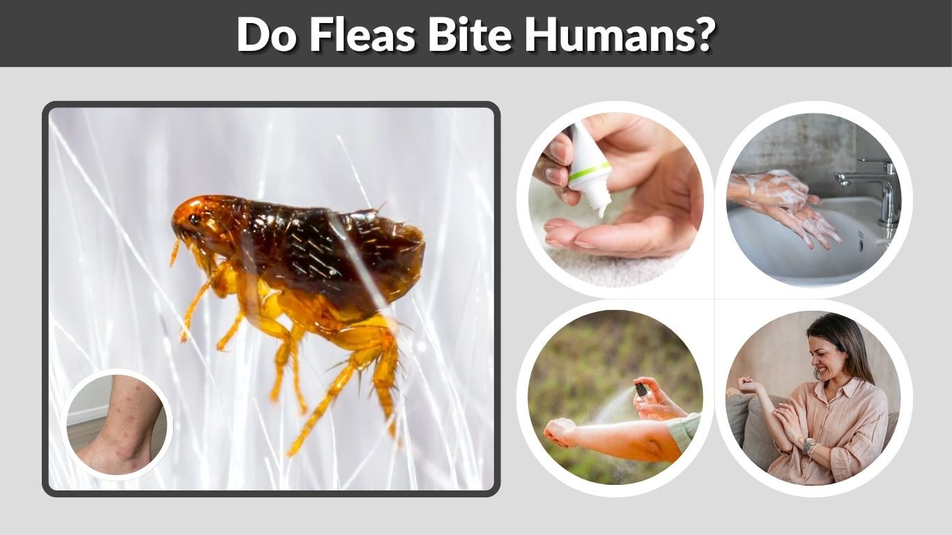 Do Fleas Bite Humans? Signs, Treatment & Prevention