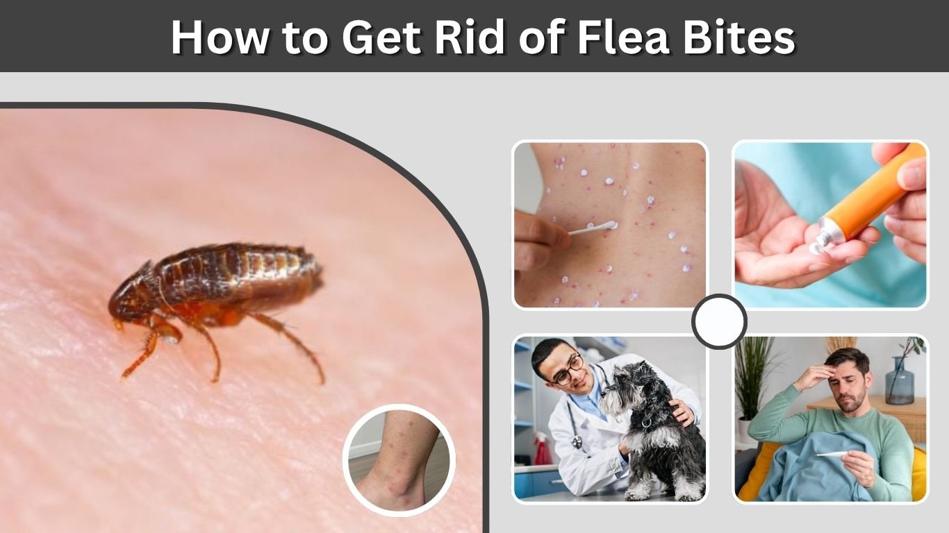 How to Get Rid of Flea Bites: Fast Relief & Treatment