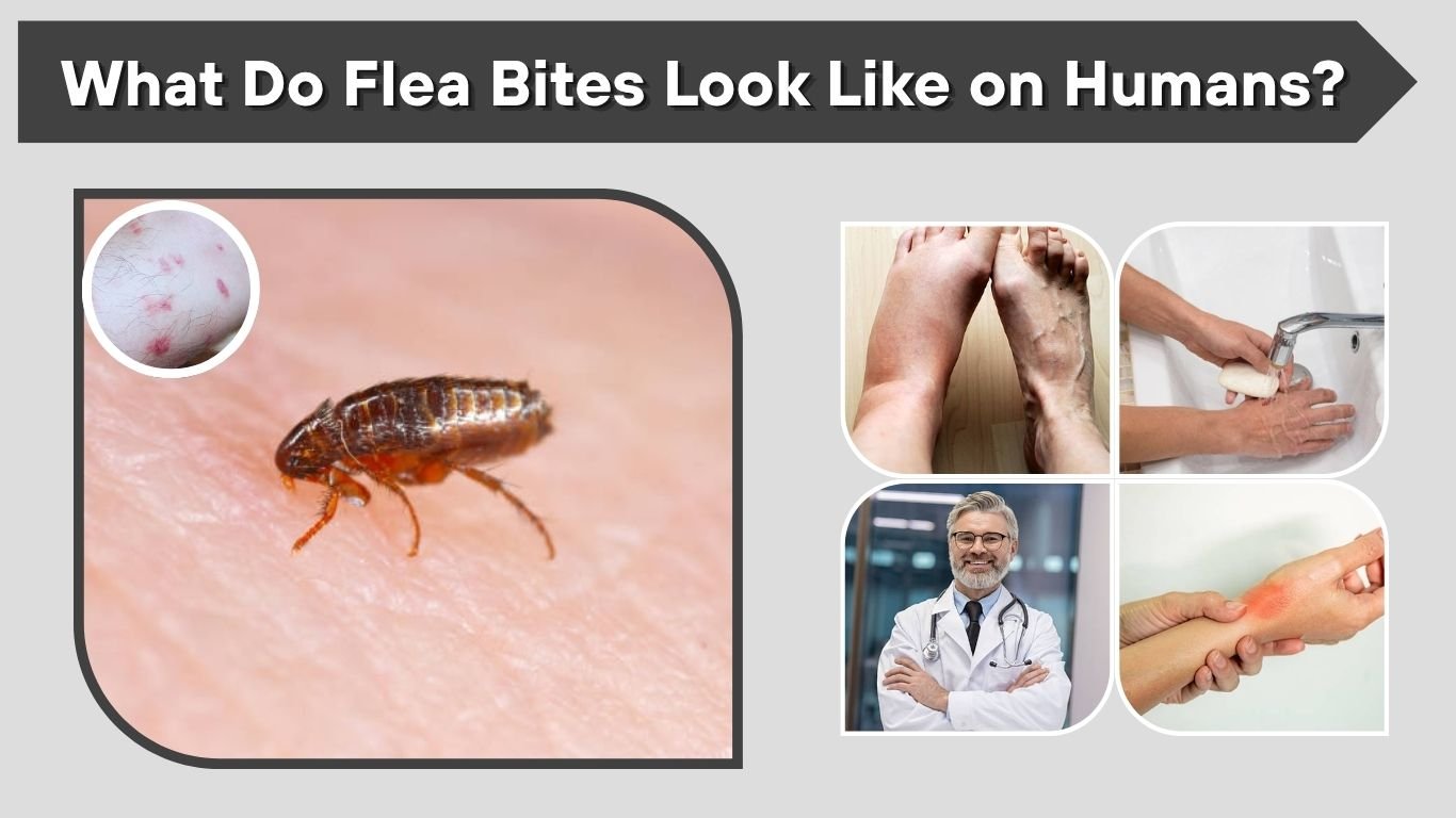 What Do Flea Bites Look Like on Humans? Signs & Care