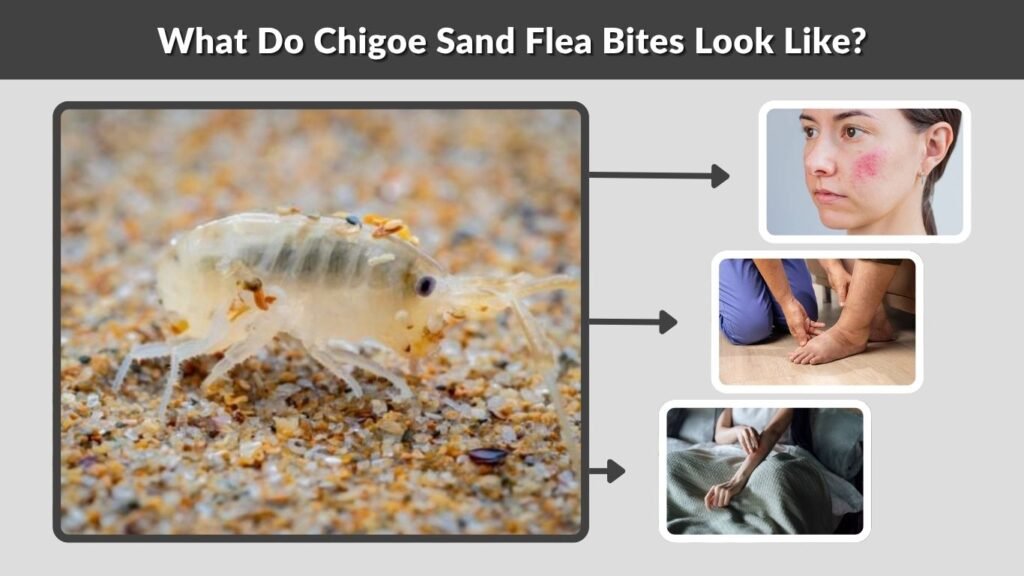 Commonly Reared Insects What Do Sand Flea Bites Look Like? Signs & Symptoms