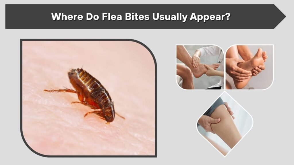 Where Do Flea Bites Usually Appear?