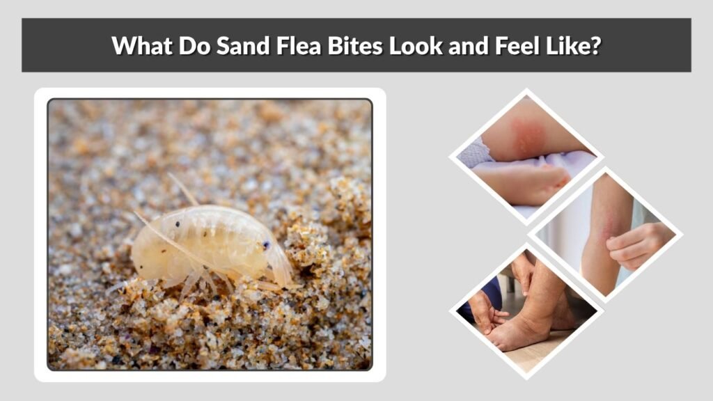 What Do Sand Flea Bites Look and Feel Like?