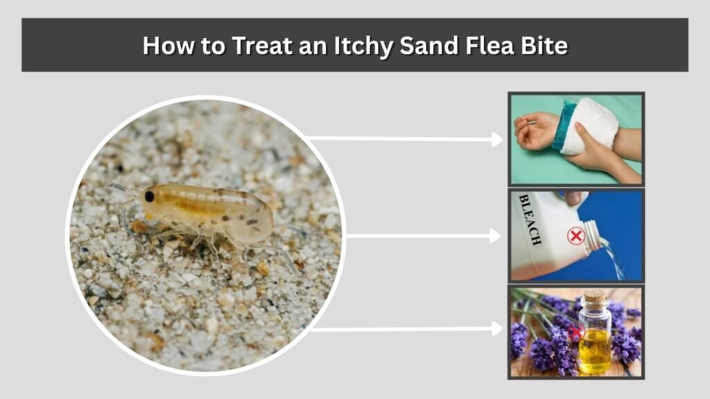 How to Treat an Itchy Sand Flea Bite
