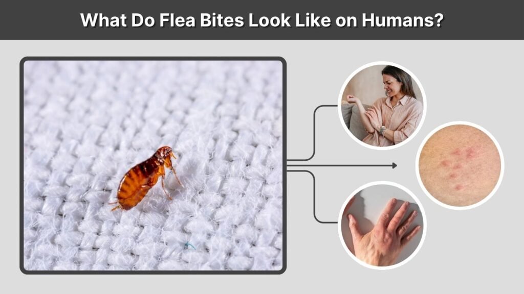 What Do Flea Bites Look Like on Humans?
